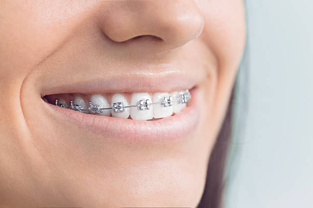Best Dental Inlays and Onlays  in Pacific, MO